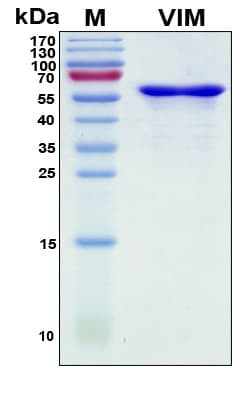Recombinant Human Vimentin Protein, Antigen Grade