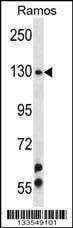 Anti-UBN2 (N-term) Antibody