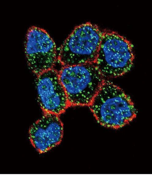 Anti-ESR1/ER (Center) Antibody