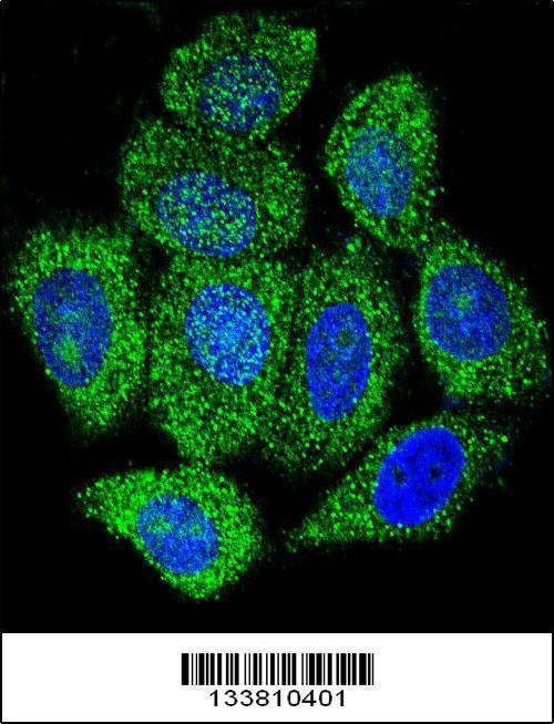 Anti-IMPDH1 (C-term) Antibody