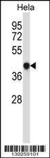 Anti-GRINA (Center) Antibody