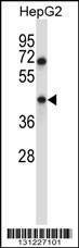 Anti-TMEM49 (C-term) Antibody