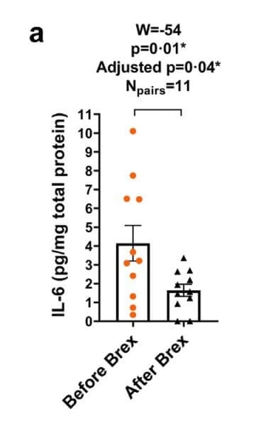 ELH-IL6 was used to measure IL-6 in whole blood cell lysates collected before and after brexanolone infusion in patients with post-partum depression. Figure adapted from Balan et al., eBioMedicine, 2023.