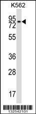 Anti-REC8 (Center) Antibody