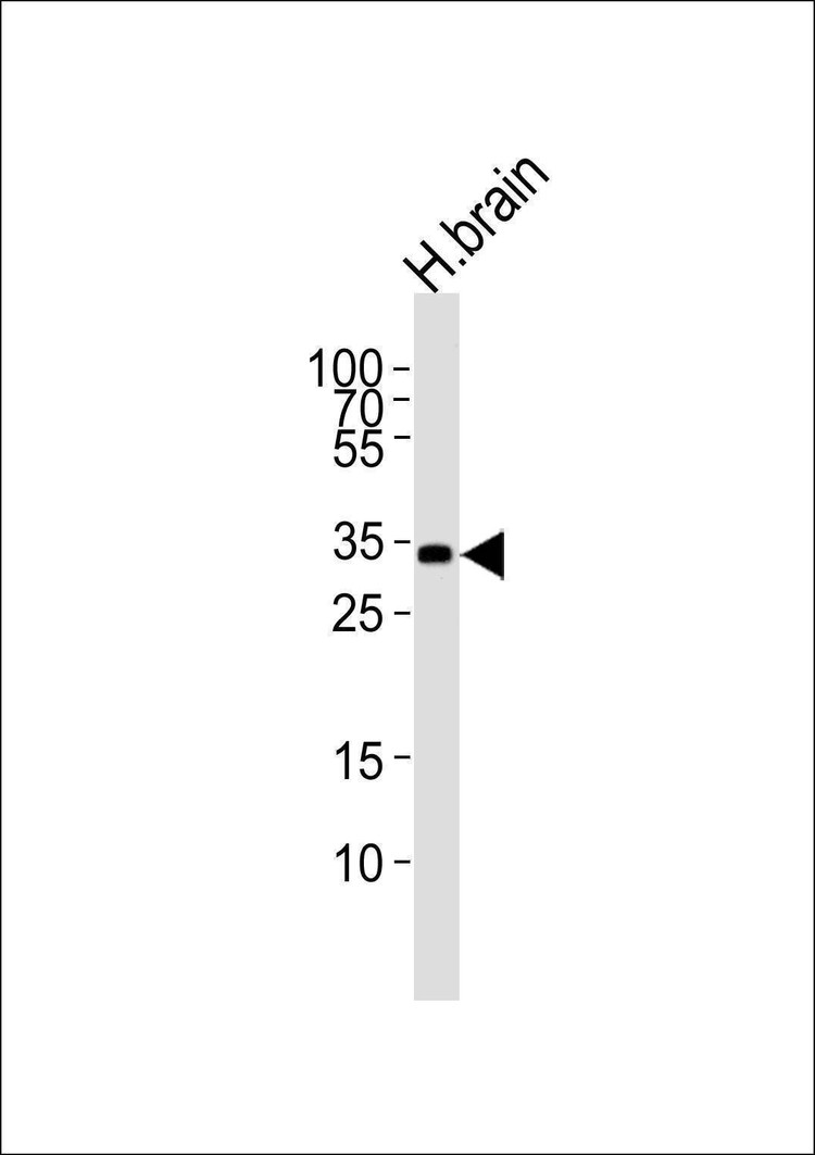 Anti-STMN4 (N-term) Antibody