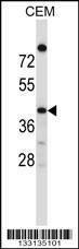 Anti-OR4C16 (C-term) Antibody