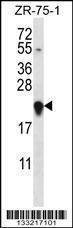 Anti-GAGE12H (N-term) Antibody