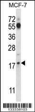Anti-SSSCA1 (N-term ) Antibody