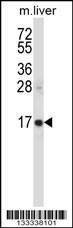 Anti-SSSCA1 (N-term ) Antibody