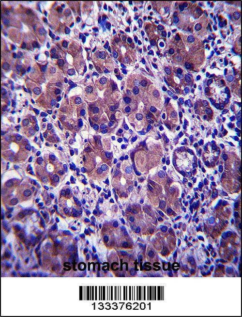 Anti-ANKRD22 (C-term) Antibody