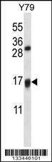 Anti-VKORC1L1 (N-term) Antibody