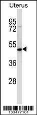 Anti-ATOH8 (N-term) Antibody