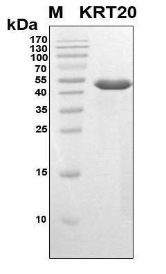 Recombinant Human KRT20 Protein, Antigen Grade