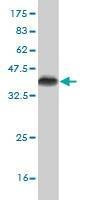 Anti-CDK4 Antibody