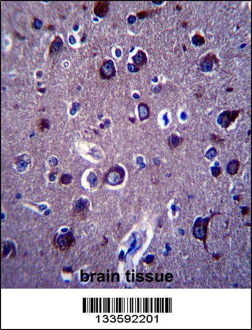 Anti-APP (Center) Antibody