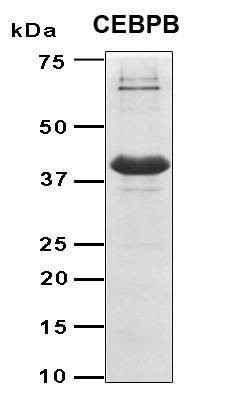 Recombinant Human CEBPB protein, Antigen Grade