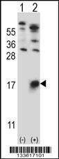 Anti-GYPB (Center) Antibody