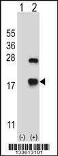 Anti-CRYAB (Center) Antibody