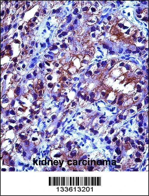Anti-CRYAB (Center) Antibody