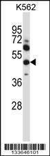 Anti-MMP13 (Center) Antibody