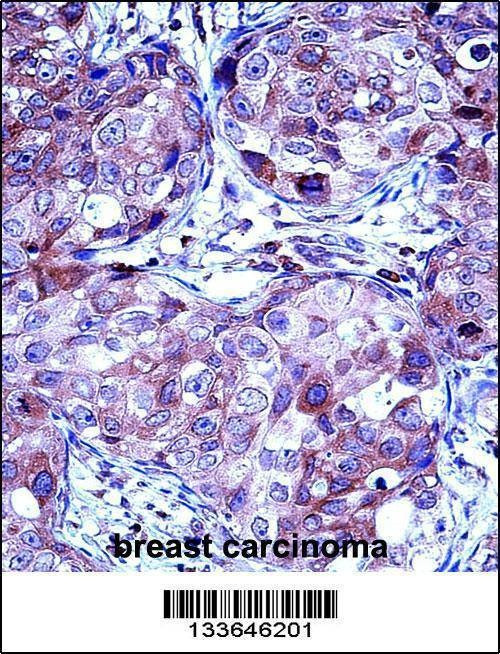 Anti-MMP13 (Center) Antibody