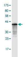 Anti-CDKN2B Antibody