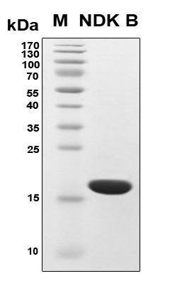 Recombinant Human NDP kinase B Protein