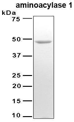 Recombinant Human Aminoacylase 1 (ACY1) Protein