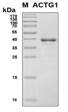 Recombinant Human Actin, gamma 1 Protein