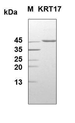 Recombinant Human Cytokeratin-17 (CK-17) Protein, Antigen Grade