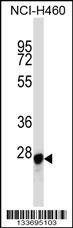 Anti-LGALS3 (C-term) Antibody