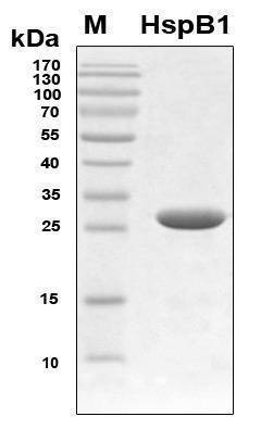 Recombinant Human HspB1 Protein