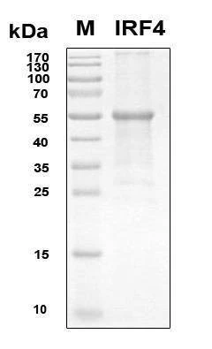 Recombinant Human IRF4 Protein, Antigen Grade