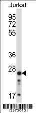 Anti-ARHGDIB (C-term) Antibody