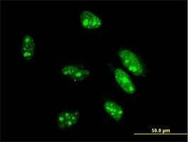 Anti-CDX1 Antibody