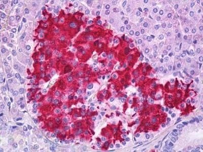 Anti-C-Peptide Antibody