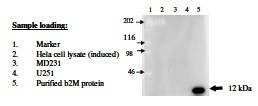 Anti-B2M Antibody