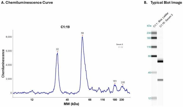 Human serum 20X | Secondary Ab: Rabbit | Exposure: 5 sec | Expected MW (kDa): 12