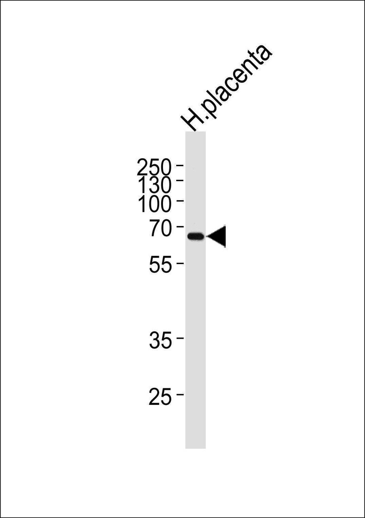 Anti-MMP19 (N-term) Antibody