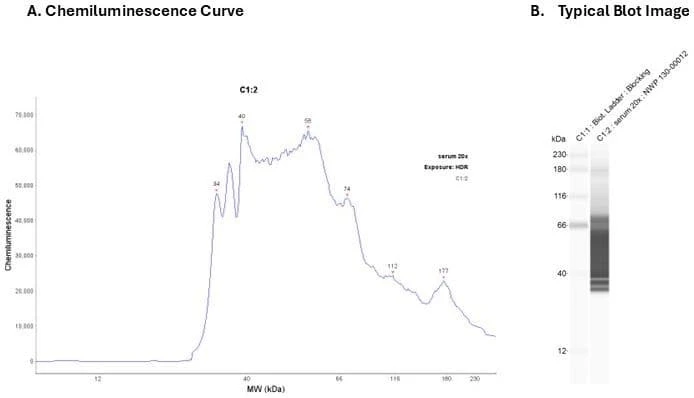 Human serum 20X | Secondary Ab: Rabbit | Exposure: HDR | Expected MW (kDa): 122