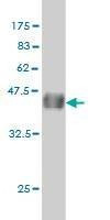 Anti-CDX4 Antibody