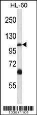 Anti-TRPC5 (N-term) Antibody