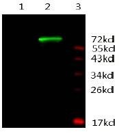 Anti-AR Antibody