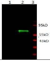 Anti-AR Antibody