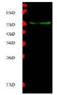 Anti-matrix metalloproteinase-10 (MMP10) Antibody