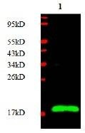 Anti-chorionic gonadotropin (CGB) Antibody