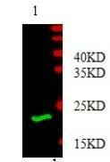 Anti-Platelet-derived growth factor subunit B (PDGFB) Antibody