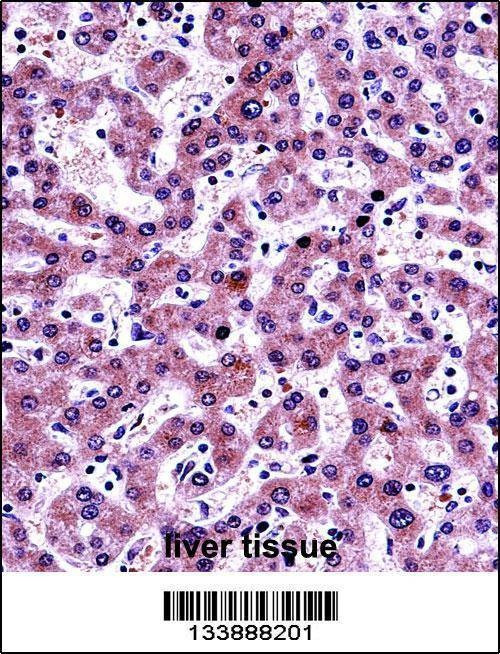 Anti-NNMT (Center) Antibody