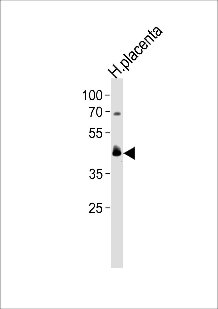Anti-PPARD (C-term) Antibody