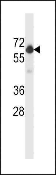 Anti-Beclin 1 Antibody